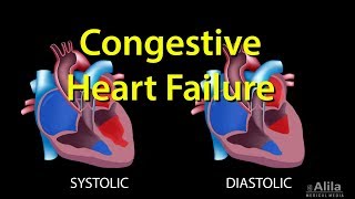 Congestive Heart Failure Leftsided vs Rightsided Systolic vs Diastolic Animation [upl. by Avert189]