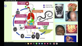 NEMATODOS Enterovius trichuris Ascaris Strongyloides Uncinarias Filariasis Oncocercosisetc💀🧫 [upl. by Bonne308]