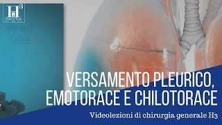 Versamento pleurico emotorace chilotorace [upl. by Surtemed592]