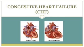 Congestive heart failure CHF Introduction Pathophysiology and Treatment 💗 [upl. by Persian830]