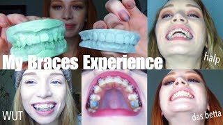 3 YEARS OF BRACES IN UNDER 30 MINS  VLOGstyle experience  transformation quotglowupquot [upl. by Selinski]