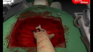 Igrajmo Surgeon Simulator 2013 Serbian [upl. by Hteik665]