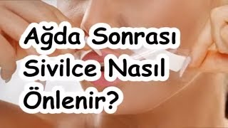 Ağda Sonrası Sivilce Nasıl Önlenir [upl. by Ennylcaj248]