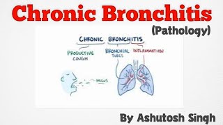 Chronic Bronchitis ll Respiratory Pathology [upl. by Moll]