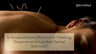 Is Acupuncture Effective in Treating Low Back Pain [upl. by Cuhp824]