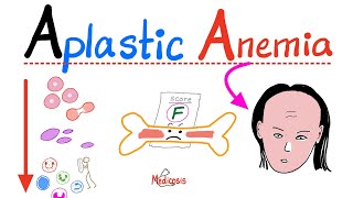 Aplastic Anemia  All you need to know  Definition Causes Symptoms Diagnosis amp Treatment [upl. by Kolk]