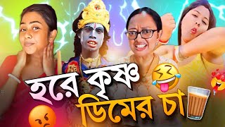 বগলে চুলে কিনা ফিল্টার 😂 [upl. by Aiekan]