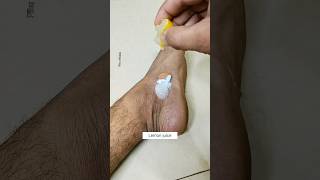 Get Fair Feet In 5min  Most Easy Pedicure  Easy SunTan Removal Pack At Home feet ytviral shorts [upl. by Short]