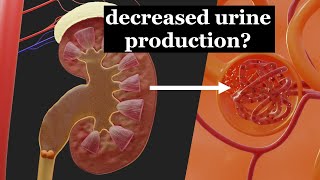 Reduced urine production due to a kidney stone [upl. by Julina366]