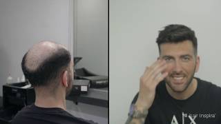 Antes y después de una prótesis capilar indetectable  Hair Inspira [upl. by White83]