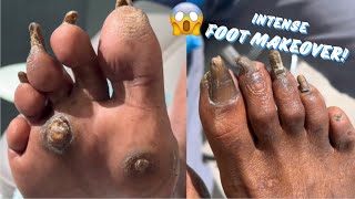 INTENSE FOOT MAKEOVER  PART 1 [upl. by Thomsen]