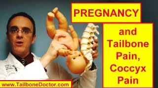 TAILBONE PAIN During PREGNANCY [upl. by Pinsky642]