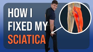 How I Healed My Sciatica Personal Recovery Story [upl. by Ahseram]