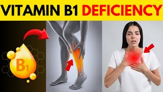 7 Unusual Vitamin B1 Deficiency Symptoms Thiamine [upl. by Ardnic]