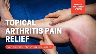 Topical Treatments for Joint Pain [upl. by Cissiee656]