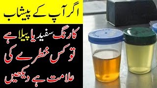 Urine Color Test I Paishab Ka Rung Safaid Ya Peela Hai [upl. by Florenza357]