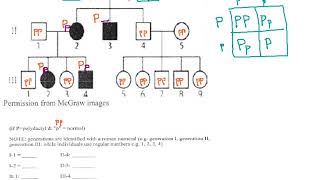 70  Pedigree Chart  Polydactyly p51 [upl. by Elton359]