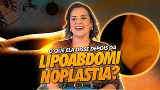 O PODER DA LIPOABDOMINOPLASTIA [upl. by Cilo380]