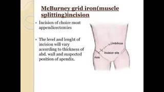 Muscle splitting incision  Mcburney Grid iron Incision during appendectomy [upl. by Ganley]