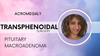 Acromegaly amp Transphenoidal Surgery [upl. by Nnayhs]