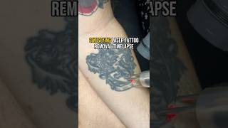 SATISFYING Laser Tattoo Removal 😍 [upl. by Violeta]