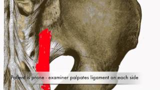 Provocation of Long Dorsal Sacroiliac Ligament Test CR [upl. by Vic]