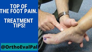 Top of the foot pain Treatment tips [upl. by Darya870]