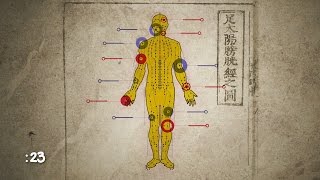 How Does Acupuncture Work  WebMD [upl. by Jacoby]