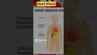 Why Do Heart Attacks Happen Medical Facts You Need to Know [upl. by Camilia652]