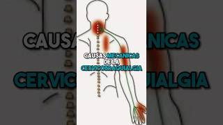 🛑 CAUSAS MECÁNICAS DE LA CERVICOBRAQUIALGIA ☝🏻 fisioterapiatualcance [upl. by Eph]