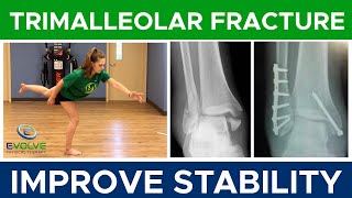 Trimalleolar Fracture  Improving Dynamic Ankle Stability  Part 1 [upl. by Halstead]