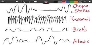 Irregular Breathing Patterns  EMTprepcom [upl. by Notlrak]