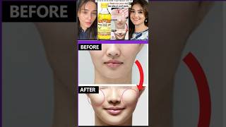 Fast Results Get Chubby Cheeks at home Fuller Cheeks Naturally with this home remedy shorts [upl. by Aneekal]