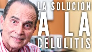 Episodio  916 La solución a la celulitis [upl. by Nilyahs]