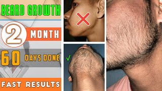 BEARD GROWTH  60 days done √ How to grow fast beard  2 months beard growth journey [upl. by Anihcak983]