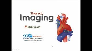 7 Mediastinum imaging  Prof Mamdouh Mahfouz [upl. by Florette82]