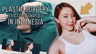 Plastic Surgery in Indonesia Rhinoplasty Procedure  Recovery  BeforeAfter Bahasa Indonesia [upl. by Sianna]