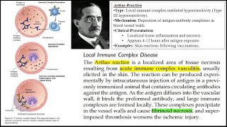 ARTHUS REACTION  PATHOLOGY PAPAER 1 RGUHS MBBS PYQs  3 Markers  Quick Review  ROBBINS [upl. by Akiemat833]