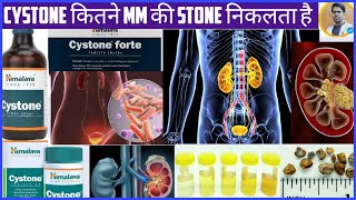 CYSTONE TABLETSYSTONE SYRUP USES AND DOSAGEKIDNEY STONE TREATMENTकिडनी की पथरी का इलाज़ [upl. by Ziana565]