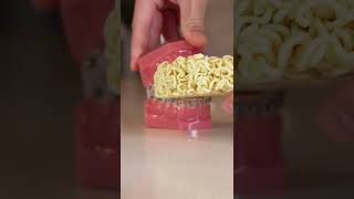 Hyperzoom Braces vs Food uncooked ramen aka Rawmen  w The Braces Doc [upl. by Wera]