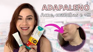 ADAPALENO ACABA COM A ACNE CLAREIA MANCHAS E MUITO MAIS [upl. by Sikorski]