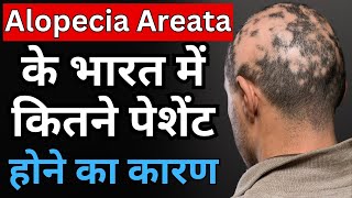 बालो में कीड़ा लगने की बीमारी क्यो बढ़ती जा रही है भारत मे  Alopecia Areata [upl. by Ardiek]