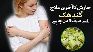 Kharish خارش Itching کھجلی Ka ilaj  Kharish Khatam Krne Ka Tarika [upl. by Aelyk]