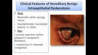 Developmental Disturbances of Soft Tissues Part2Oral Pathologywmv [upl. by Gilbertine]