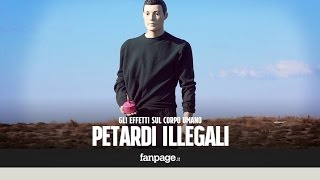 Gli effetti devastanti di un petardo illegale sul corpo umano [upl. by Ayekal]