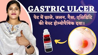 Gastric ulcer  पेट में छाले जलन बदहज़्मी की बेस्ट दवा  Peptic ulcer Treatment  Dr Arwa Bohra [upl. by Hadleigh]