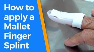 How to apply a Mallet Finger Splint [upl. by Sharl780]