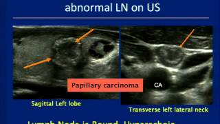 Thyroid Ultrasound Course [upl. by Nylirehc679]