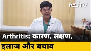 What Causes Rheumatoid Arthritis  क्या होता है गठ‍िया  आर्थराइटिस के कारण लक्षण इलाज और बचाव [upl. by Daub444]