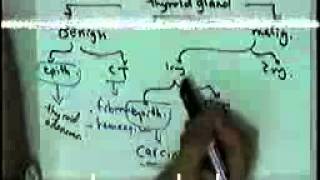 SYSTEMIC PATHOLOGY endocrine 2 DR SAMEH GHAZY [upl. by Isolda]